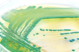 Jūsų gyvybei gresia didelis pavojus: mirtinos bakterijos sklinda nesustabdomai