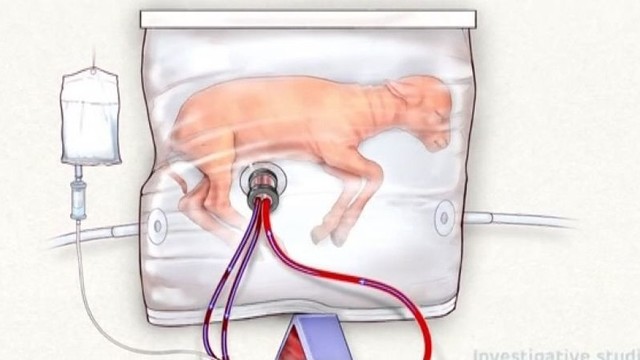 Mokslininkai kuria dirbtinę gimdą, kuri gelbėtų neišnešiotų kūdikių gyvybes