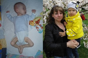 Mamos nerimas – ne be reikalo: kūdikio nenoras valgyti reiškė baisią ligą