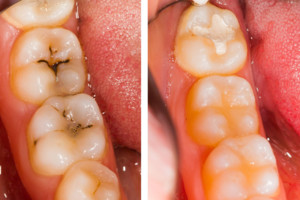 Odontologės patarimai padės sutaupyti laiko ir pinigų