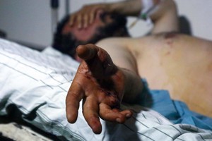 „Islamo valstybės“ ataka Sirijoje pareikalavo kelių dešimčių žmonių gyvybių