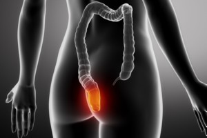 Viena grėsminga vėžio rūšis lietuvius puola vis dažniau 