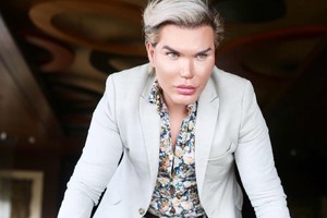 Lėlė Kenas Rodrigo Alvesas toliau šokiruoja – ryžosi 58-ajai operacijai