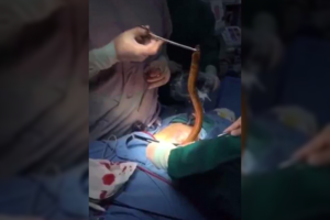 Medikai apstulbo pamatę, ką į save susikišo vyras dėl lytinio pasitenkinimo