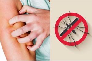 Tik viena priemonė, ir uodai jūsų nebekąs