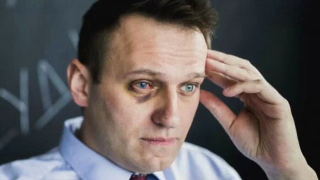 Rusijos opozicijos lyderiui Aleksejui Navalnui atlikta sudėtinga akių operacija