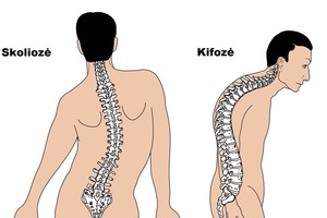 Rimta sveikatos problema dažnai prasideda nepastebimai