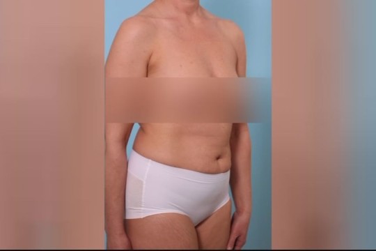 Vagys internete paviešino visų „Grožio klinikos“ klientų duomenis