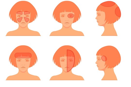 Galvos skausmai gali pranašauti ir baisią ligą: kai kuriais atvejais turite skubėti pas gydytoją