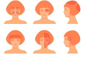 Galvos skausmai gali pranašauti ir baisią ligą: kai kuriais atvejais turite skubėti pas gydytoją