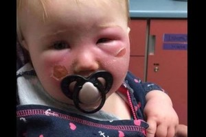 Noras apsaugoti vaiką baigėsi šiurpiai – perspėja visus tėvus