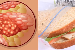 Nepatikėsite: net ir šie produktai gali sukelti vėžį
