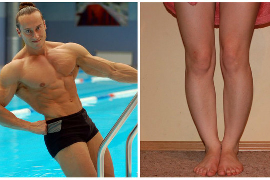 Gėdijatės storų blauzdų? Treneris paaiškino, kas veikia blauzdos dydį