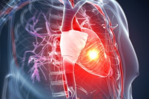 Liga, užpuolanti net ir sveikuolius – sužinokite, kaip apsisaugoti