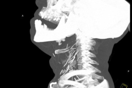 Alt photo text