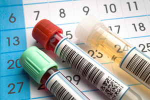 Proveržis medicinoje: paprastas testas leis daug tiksliau sužinoti, ar sergate vėžiu