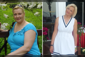 30 kg netekusi vilnietė: „Pokyčiai nustebino jau pirmą dietos mėnesį“
