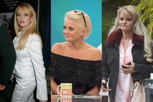 Narkotikai garsią 43-ejų aktorę subjaurojo negrįžtamai