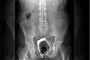 Gydytojai pakraupę – italo seksualinė fantazija baigėsi ligoninėje