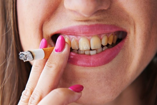 Mitai apie dantų priežiūrą, kuriais tiki visi, o veltui