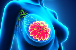 Vėžys nusineša vis daugiau moterų gyvybių: svarbiausia, ką turite žinoti