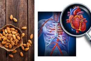 Kiekvieną dieną suvalgykite po keturis migdolus – rezultatai nustebins