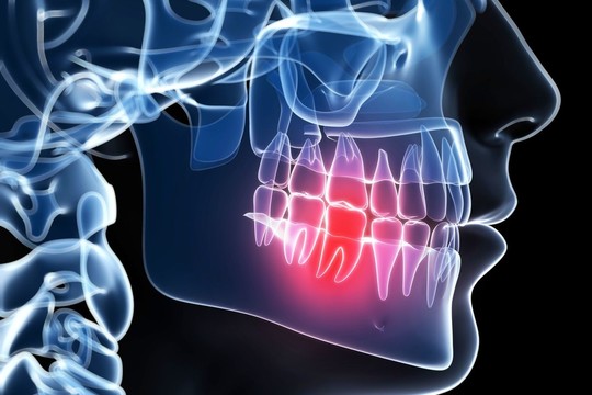 Paprasti receptai nuo dantų skausmo: išbandžiusieji dalijasi su kitais