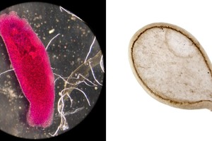 Organizme knibždančių parazitų atsikratysite vos viena natūralia priemone