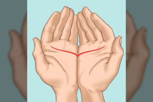 Pažvelkite į savo delnus: sužinosite daugiau, nei galėjote pagalvoti