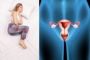 Kas mėnesį raitytis iš skausmo neteks, jei pasinaudosite šiuo patarimu