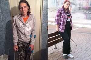 Gyva pūti pradėjusi narkomanė tokios baigties nesitikėjo 