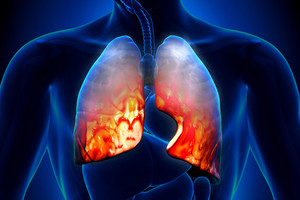 Nuo itin gyvybei pavojingos infekcijos apsaugos nemokamai