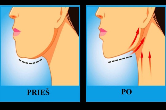 Vos kelios minutės per dieną padės atjaunėti bent 10 metų