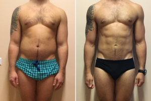 15 kg atsikratęs vyras turi tris patarimus norintiems sulieknėti