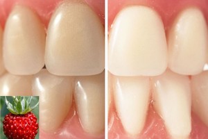 Patrinkite žemuogėmis dantis – pamatę rezultatą, norėsite pakartoti