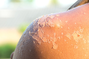 Jūs dažnai darote šias klaidas ir rizikuojate sau labai pakenkti