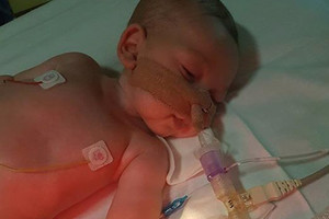 Pasaulį sukrėtusi istorija dar nebaigta: merdinčiam berniukui sužibo viltis