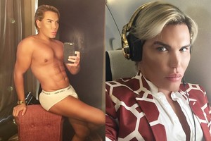 Nuo operacijų priklausomas brazilas išgirdo šokiruojantį gydytojų verdiktą