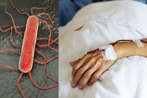 Šiemet jau du lietuviai mirė užsikrėtę pavojingomis bakterijomis: nedarykite šių klaidų