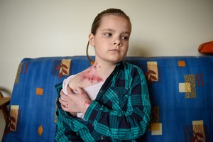 Lietuvių šeimų košmaras: „drugelių vaikų“ lemtis spaudžia ašaras