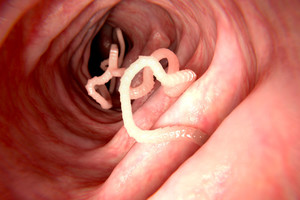 Kirmėlės gali sukelti ir rimtų problemų: natūralūs receptai padės apsisaugoti