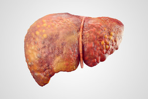 Nemalonus kelionės „suvenyras“ – kepenų žudikas, kurio nepajaučiate