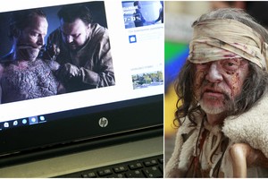 Šios ligos epidemija įkvėpė „Sostų karų" kūrėjus