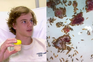 Pasaulis šokiruotas: į jūrą kojas įmerkęs paauglys patyrė žiaurius sužalojimus