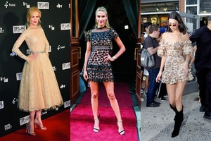 „Stiliaus“ nuosprendis: šios savaitės stilingiausios