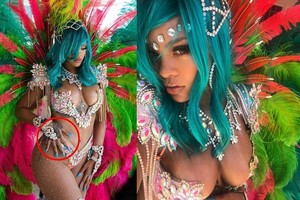 Rihanna persistengė su „Photoshop“ dailindama savo nuotrauką 