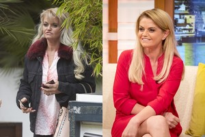 Iš narkotikų liūno išsikapsčiusi aktorė parodė plastinių operacijų rezultatą