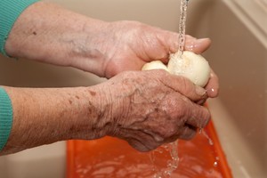 Sunkus parazitinis susirgimas užklupo keturiskart daugiau žmonių nei pernai