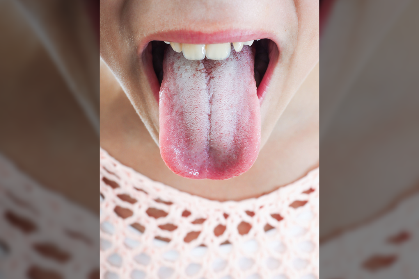  Atskleidė, ką apie jūsų sveikatą pasako liežuvio išvaizda.<br> 123rf.com nuotr.