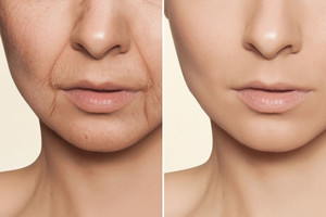 Vos du ingredientai leis džiaugtis net 10 metų jaunesne oda